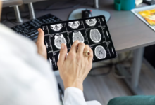 Beyond Symptoms: Using A Brain Scan To Confirm Alzheimer’s