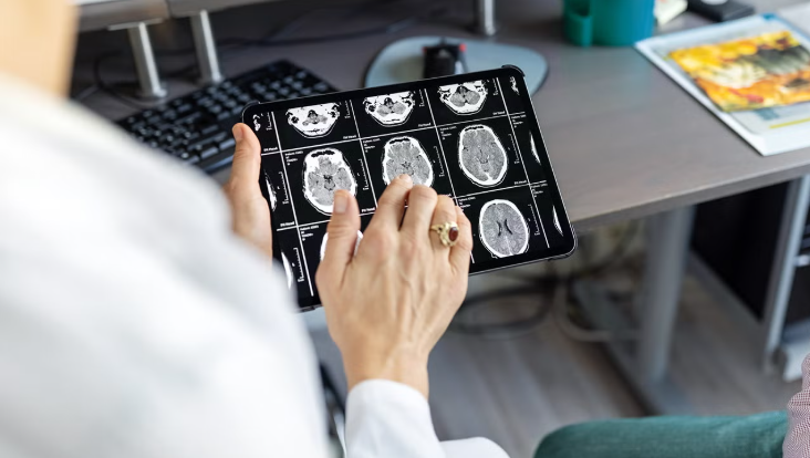 Beyond Symptoms: Using A Brain Scan To Confirm Alzheimer’s
