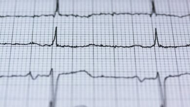 radiant pulse revenue strategy