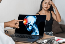 The True Cost Of Traumatic Brain Injuries: What To Expect From A Settlement